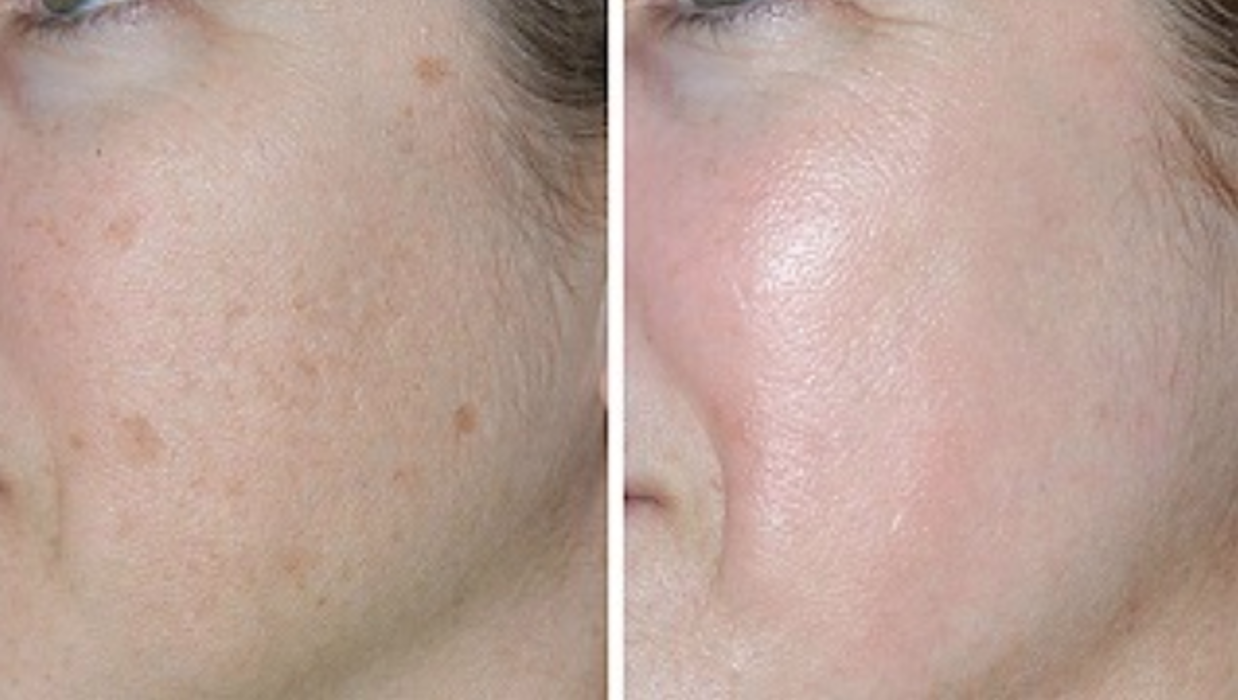 Eugenie Brunner, MD, FACS - Princeton, NJ