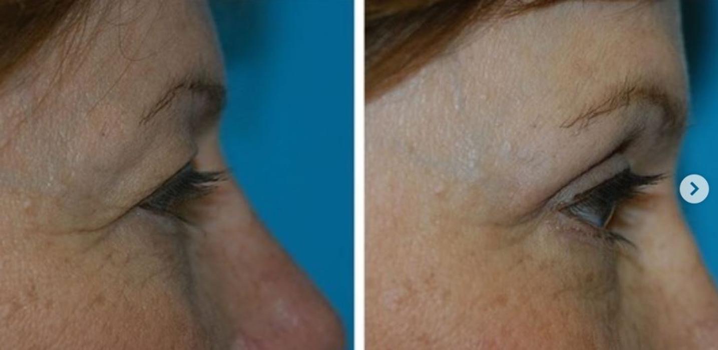 Eugenie Brunner, MD, FACS - Princeton, NJ