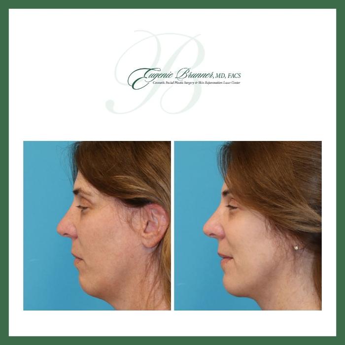 Eugenie Brunner, MD, FACS - Princeton, NJ