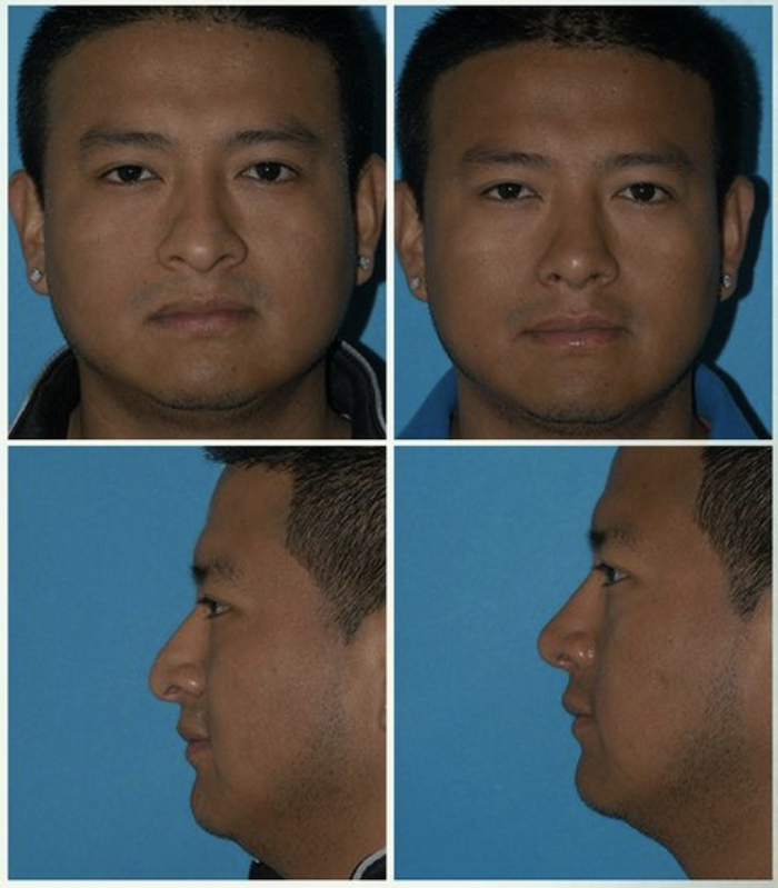 Eugenie Brunner, MD, FACS - Princeton, NJ