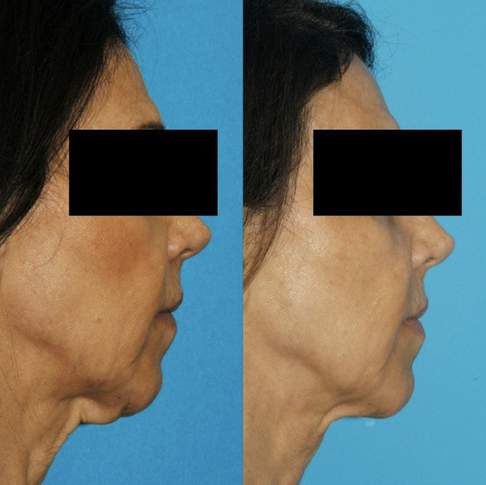 Eugenie Brunner, MD, FACS - Princeton, NJ