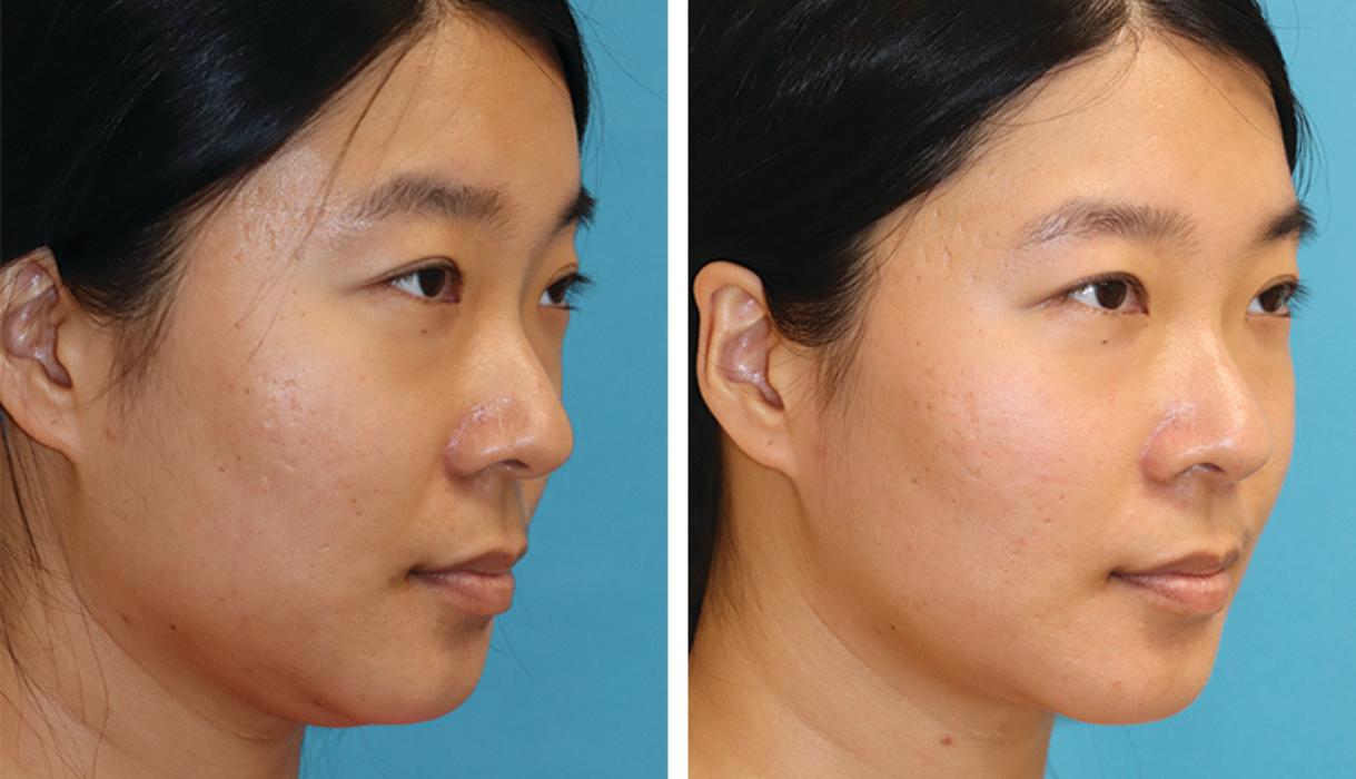 Eugenie Brunner, MD, FACS - Princeton, NJ