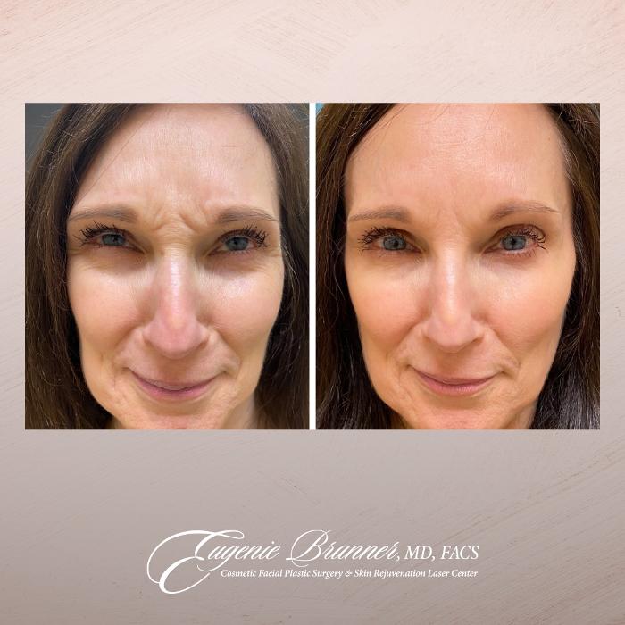 Eugenie Brunner, MD, FACS - Princeton, NJ