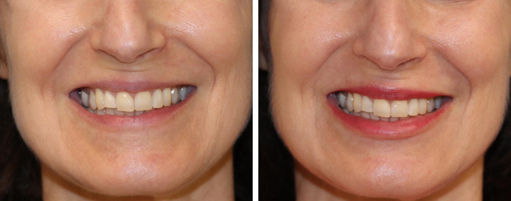 Eugenie Brunner, MD, FACS - Princeton, NJ