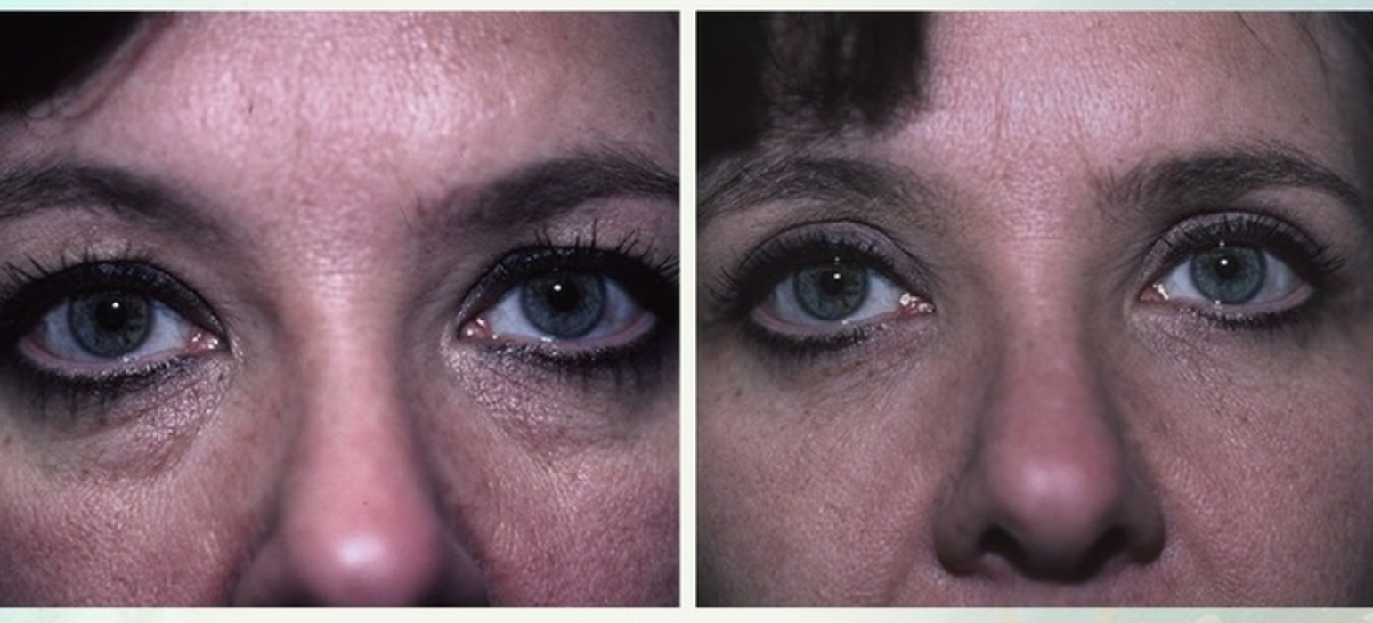 Eugenie Brunner, MD, FACS - Princeton, NJ