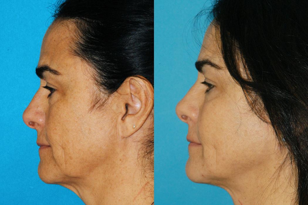 Eugenie Brunner, MD, FACS - Princeton, NJ