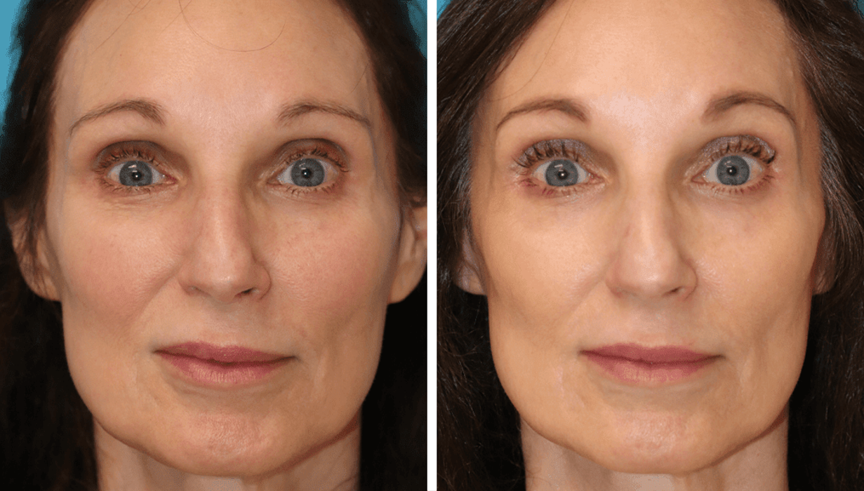 Eugenie Brunner, MD, FACS - Princeton, NJ