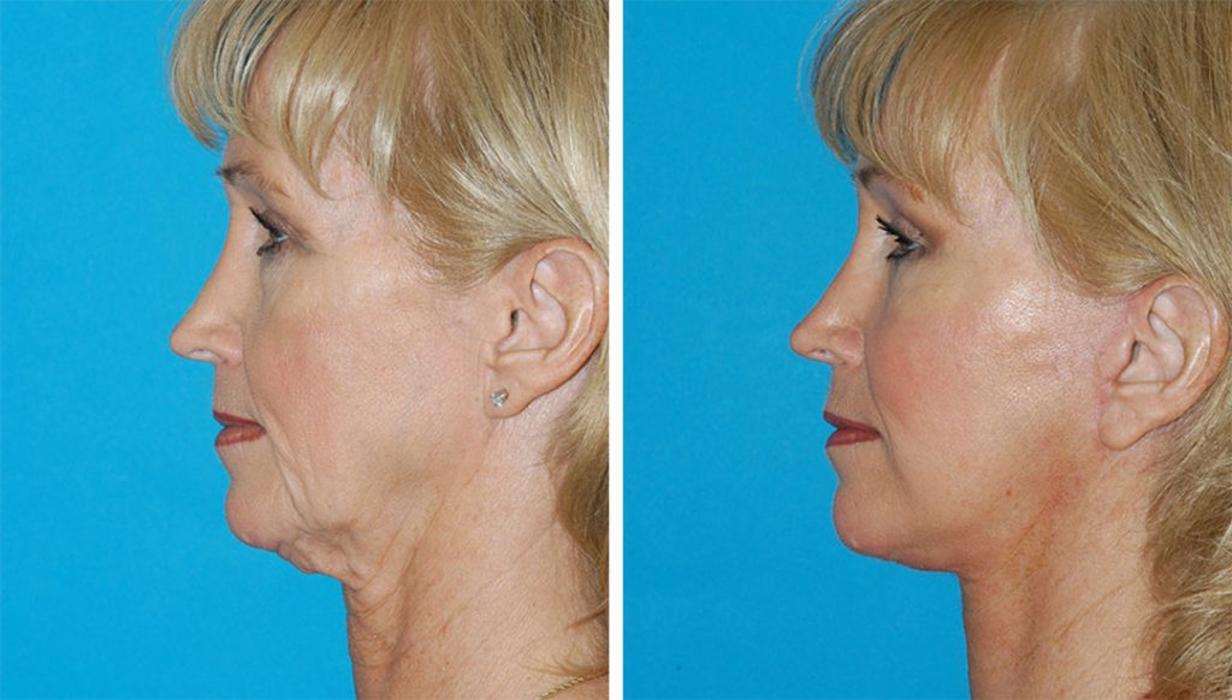 Eugenie Brunner, MD, FACS - Princeton, NJ