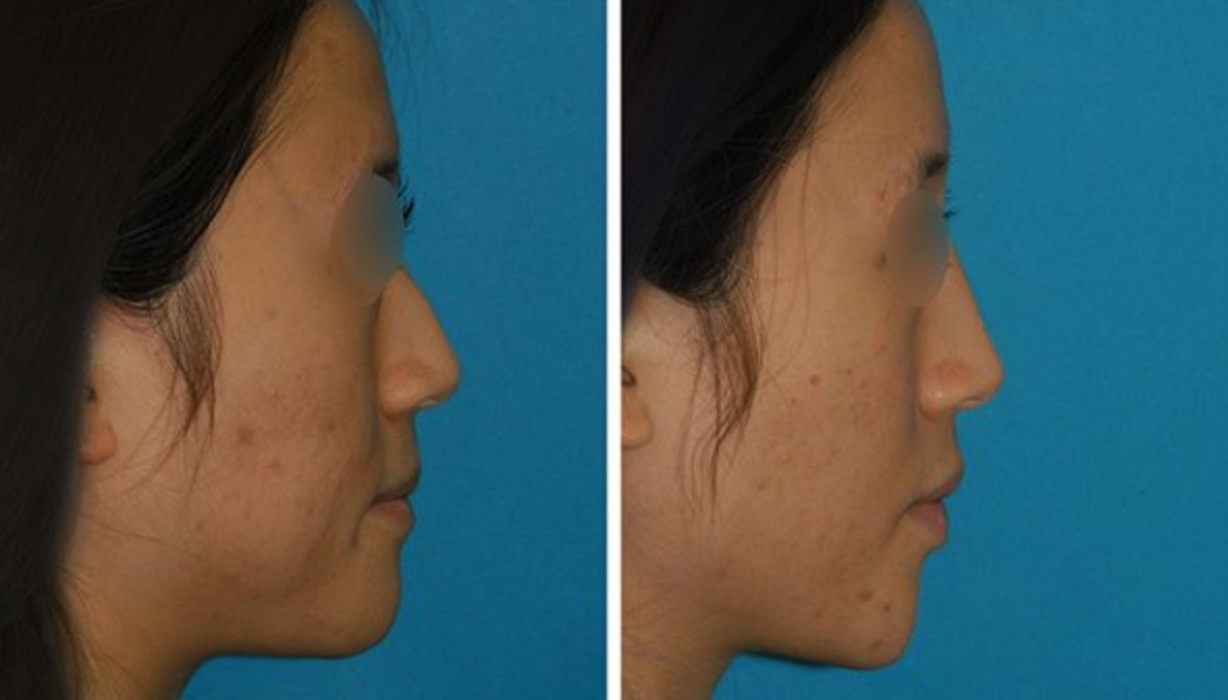 Eugenie Brunner, MD, FACS - Princeton, NJ