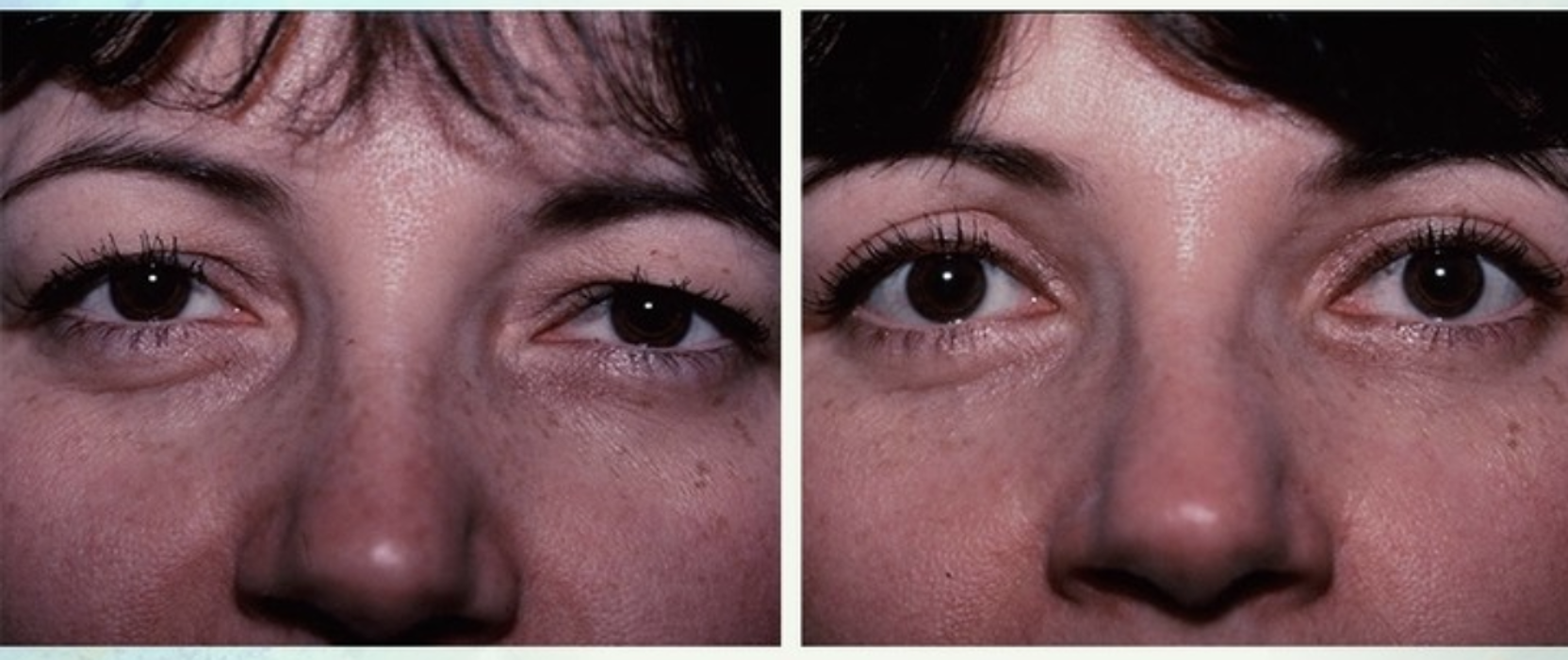 Eugenie Brunner, MD, FACS - Princeton, NJ