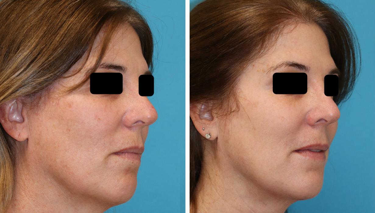 Eugenie Brunner, MD, FACS - Princeton, NJ