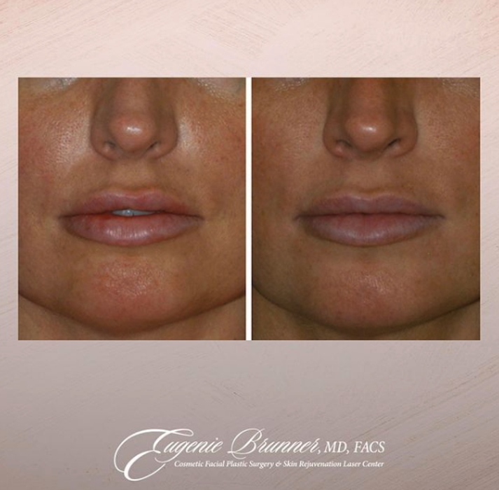 Eugenie Brunner, MD, FACS - Princeton, NJ