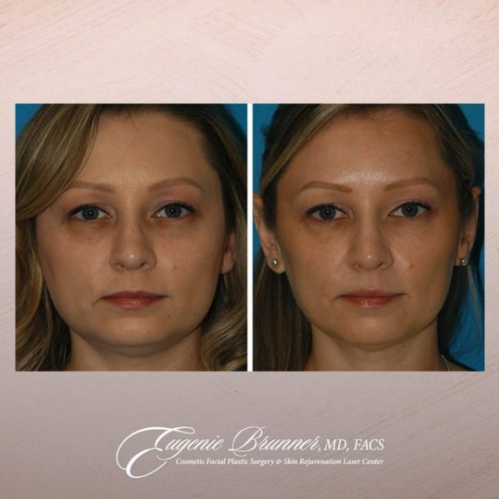 Eugenie Brunner, MD, FACS - Princeton, NJ