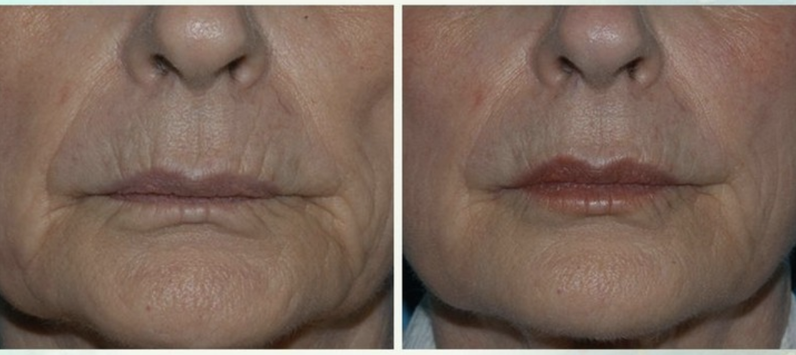 Eugenie Brunner, MD, FACS - Princeton, NJ