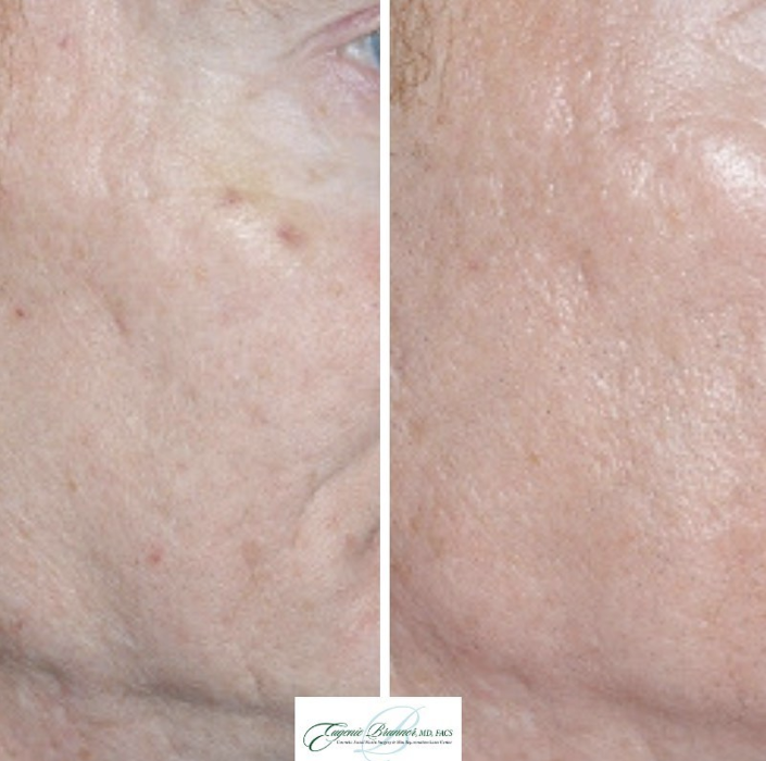 Eugenie Brunner, MD, FACS - Princeton, NJ