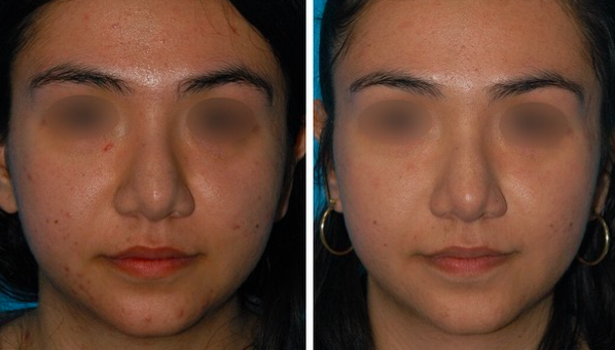 Eugenie Brunner, MD, FACS - Princeton, NJ