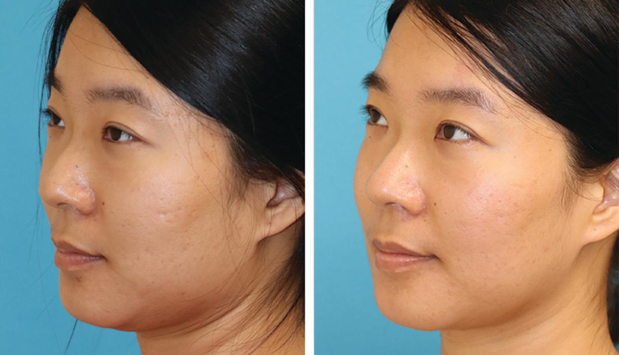 Eugenie Brunner, MD, FACS - Princeton, NJ