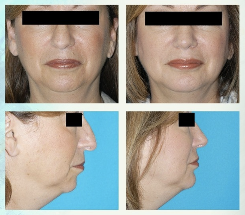 Eugenie Brunner, MD, FACS - Princeton, NJ