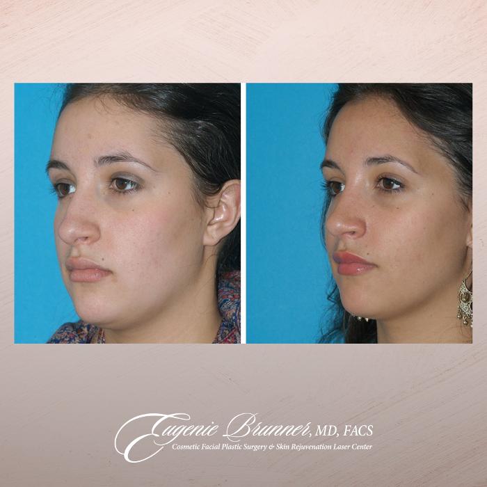 Eugenie Brunner, MD, FACS - Princeton, NJ