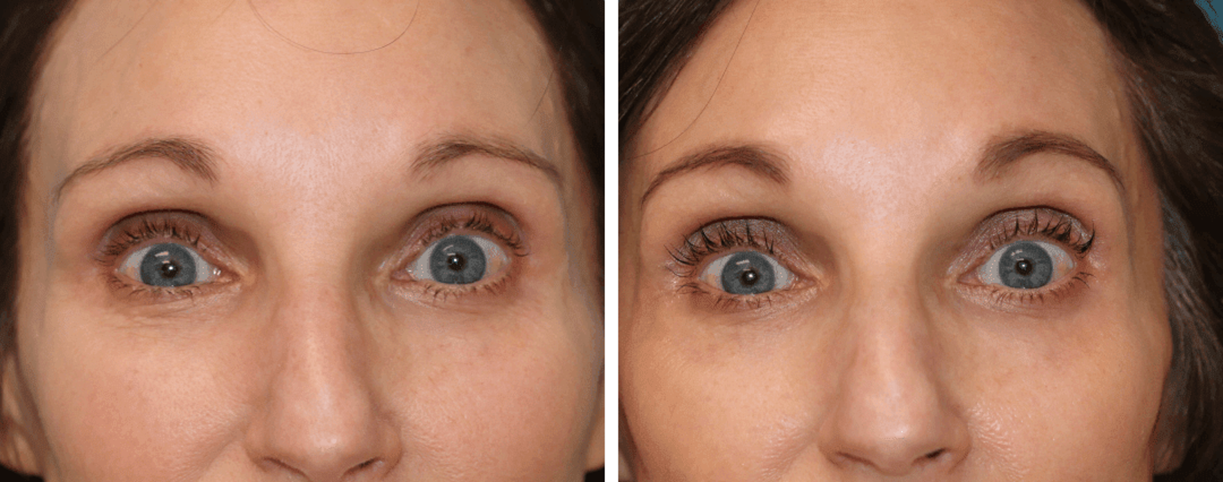 Eugenie Brunner, MD, FACS - Princeton, NJ