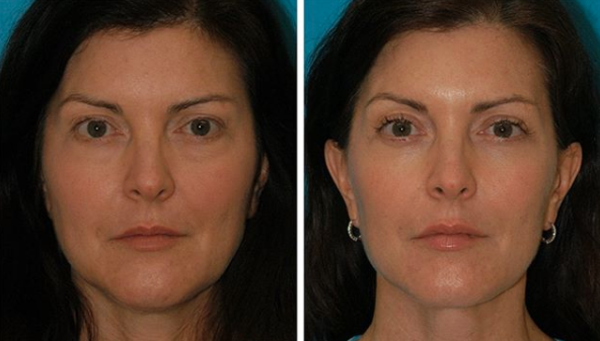 Eugenie Brunner, MD, FACS - Princeton, NJ