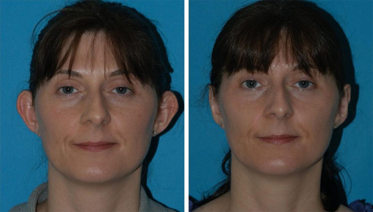 Eugenie Brunner, MD, FACS - Princeton, NJ