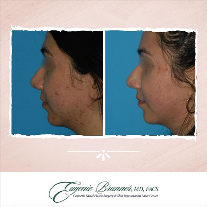 Eugenie Brunner, MD, FACS - Princeton, NJ