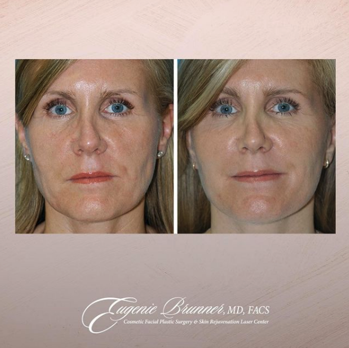 Eugenie Brunner, MD, FACS - Princeton, NJ