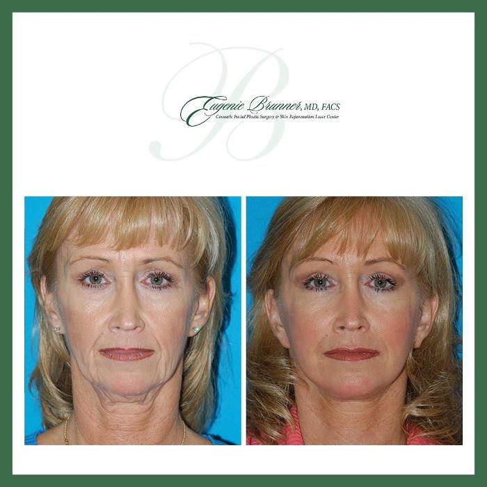 Eugenie Brunner, MD, FACS - Princeton, NJ