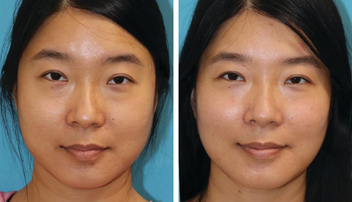 Eugenie Brunner, MD, FACS - Princeton, NJ