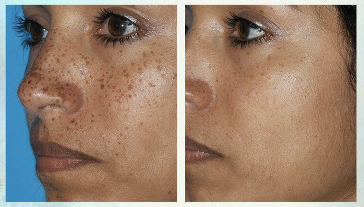 Eugenie Brunner, MD, FACS - Princeton, NJ