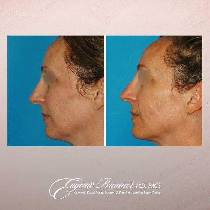 Eugenie Brunner, MD, FACS - Princeton, NJ