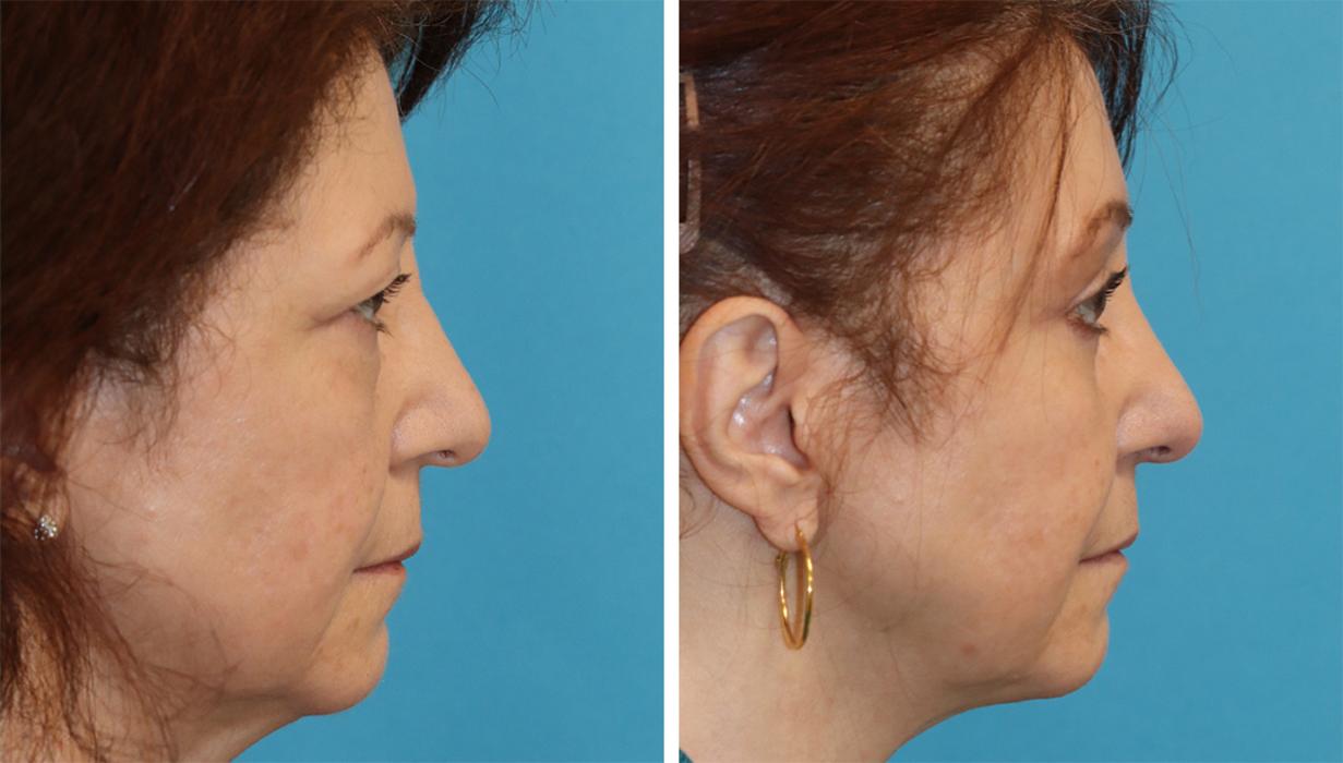 Eugenie Brunner, MD, FACS - Princeton, NJ