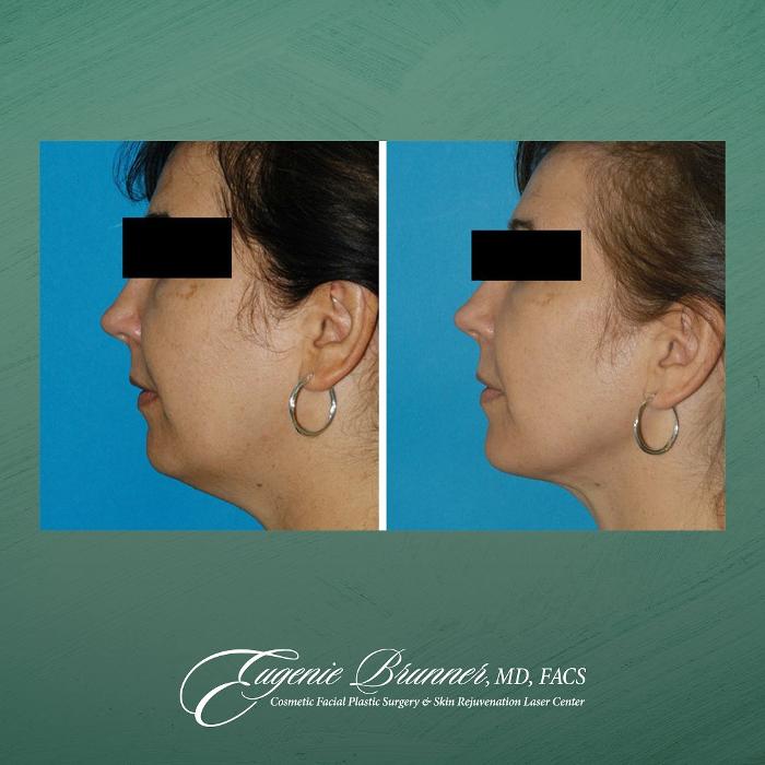 Eugenie Brunner, MD, FACS - Princeton, NJ