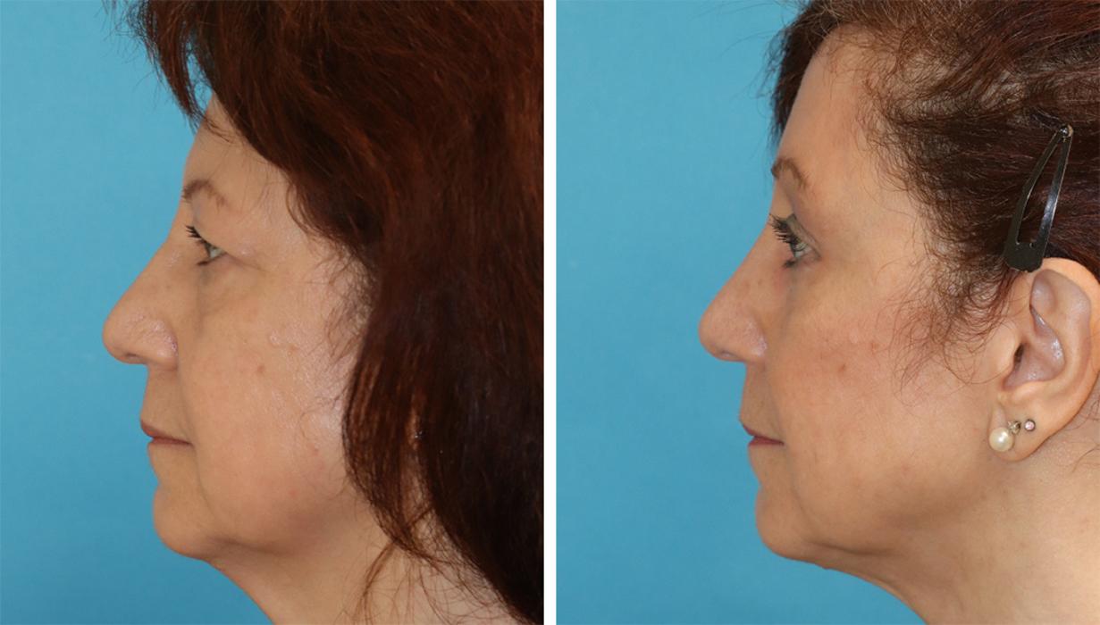 Eugenie Brunner, MD, FACS - Princeton, NJ