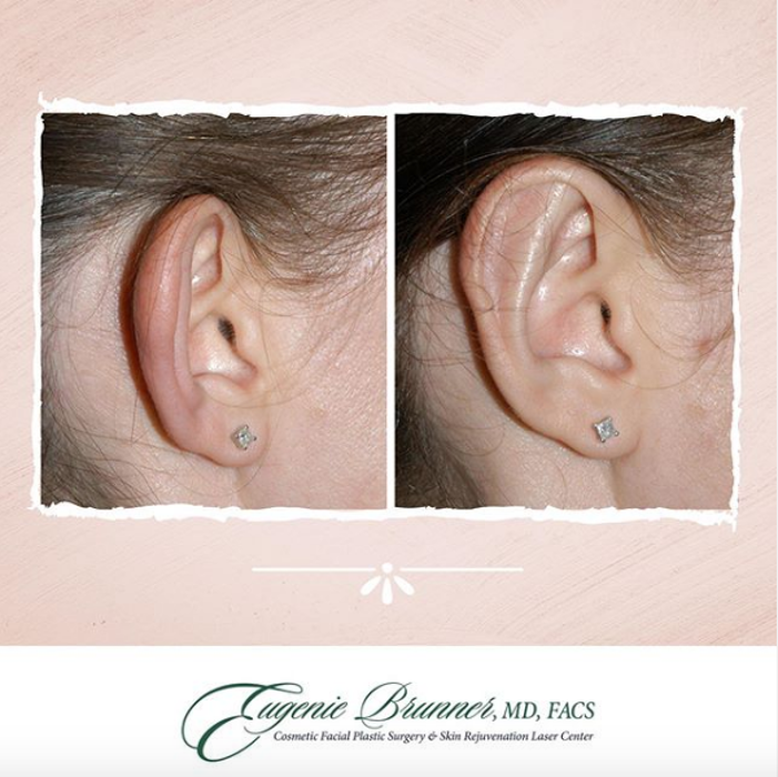 Eugenie Brunner, MD, FACS - Princeton, NJ