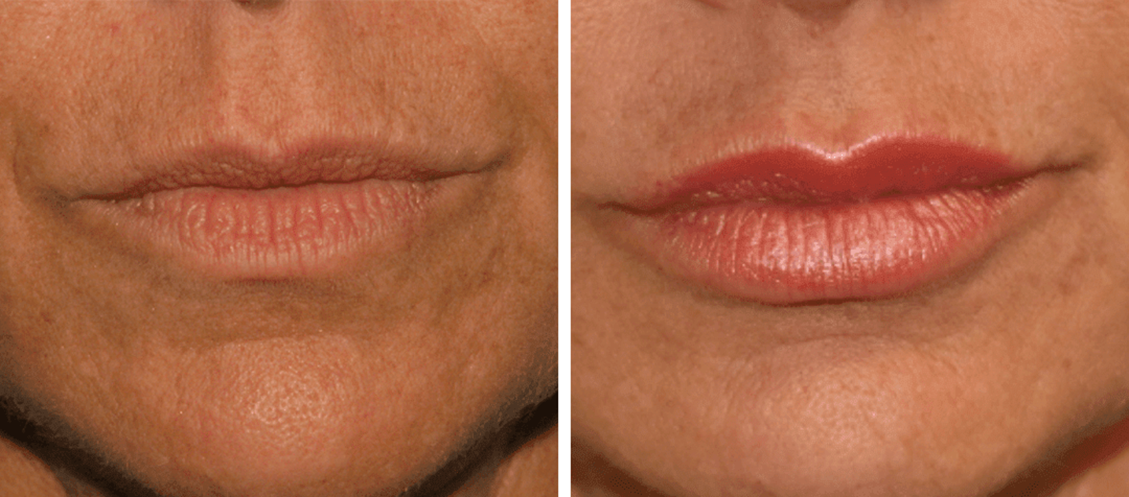 Eugenie Brunner, MD, FACS - Princeton, NJ