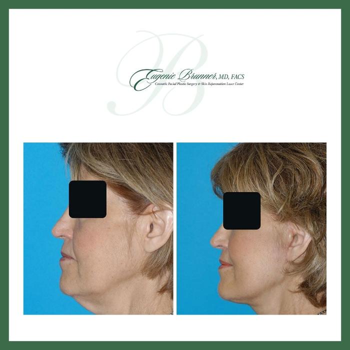 Eugenie Brunner, MD, FACS - Princeton, NJ