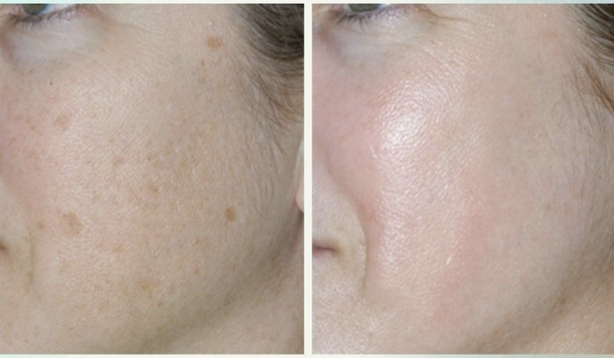 Eugenie Brunner, MD, FACS - Princeton, NJ