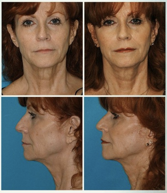 Eugenie Brunner, MD, FACS - Princeton, NJ