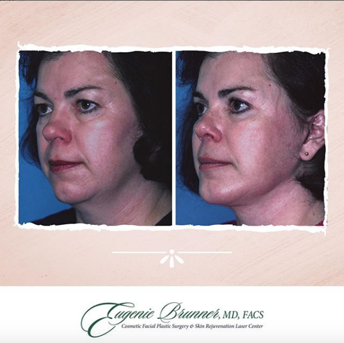 Eugenie Brunner, MD, FACS - Princeton, NJ