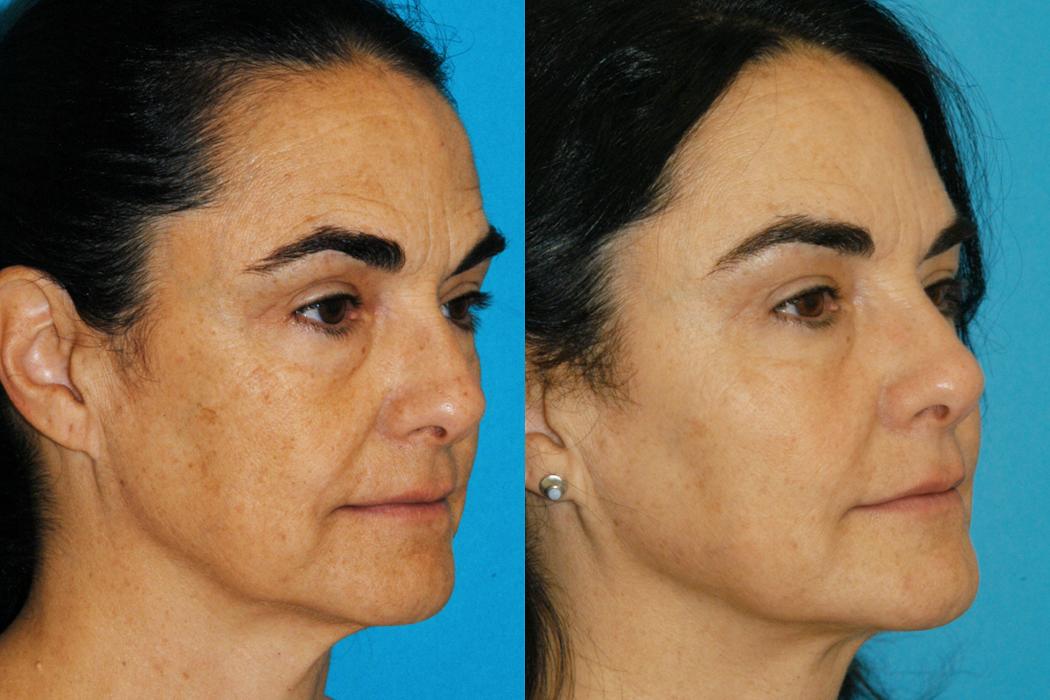 Eugenie Brunner, MD, FACS - Princeton, NJ