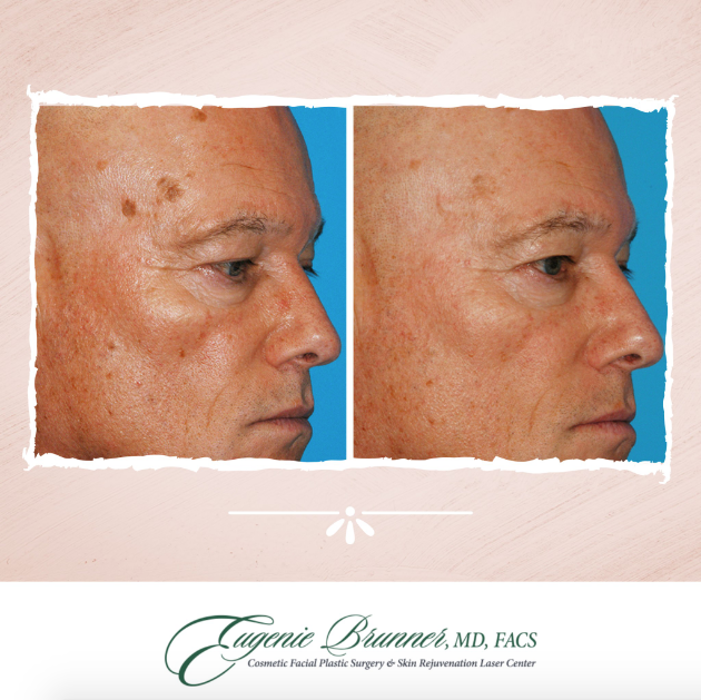 Eugenie Brunner, MD, FACS - Princeton, NJ