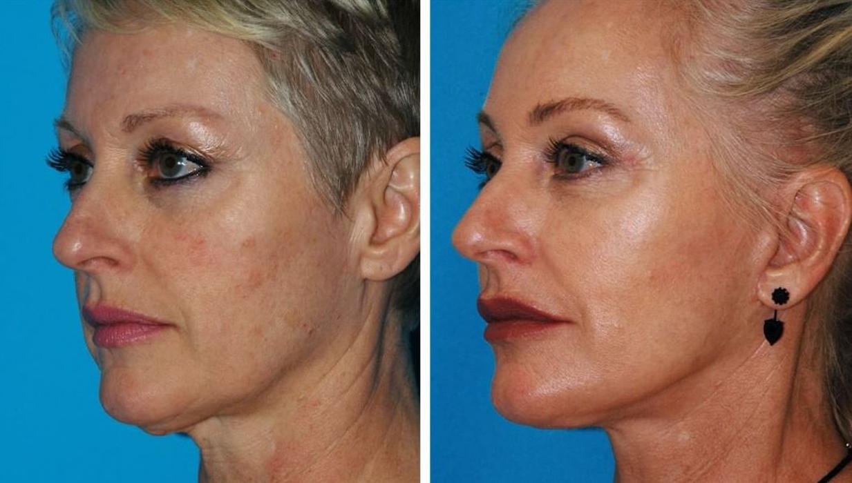 Eugenie Brunner, MD, FACS - Princeton, NJ