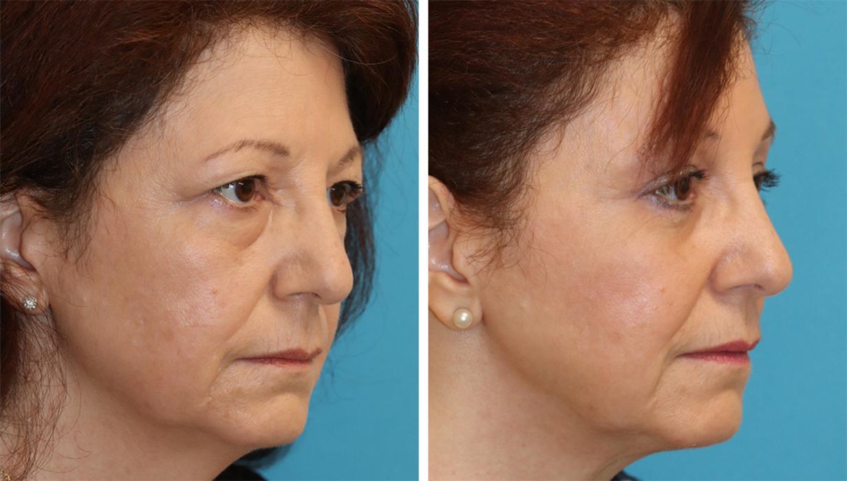 Eugenie Brunner, MD, FACS - Princeton, NJ