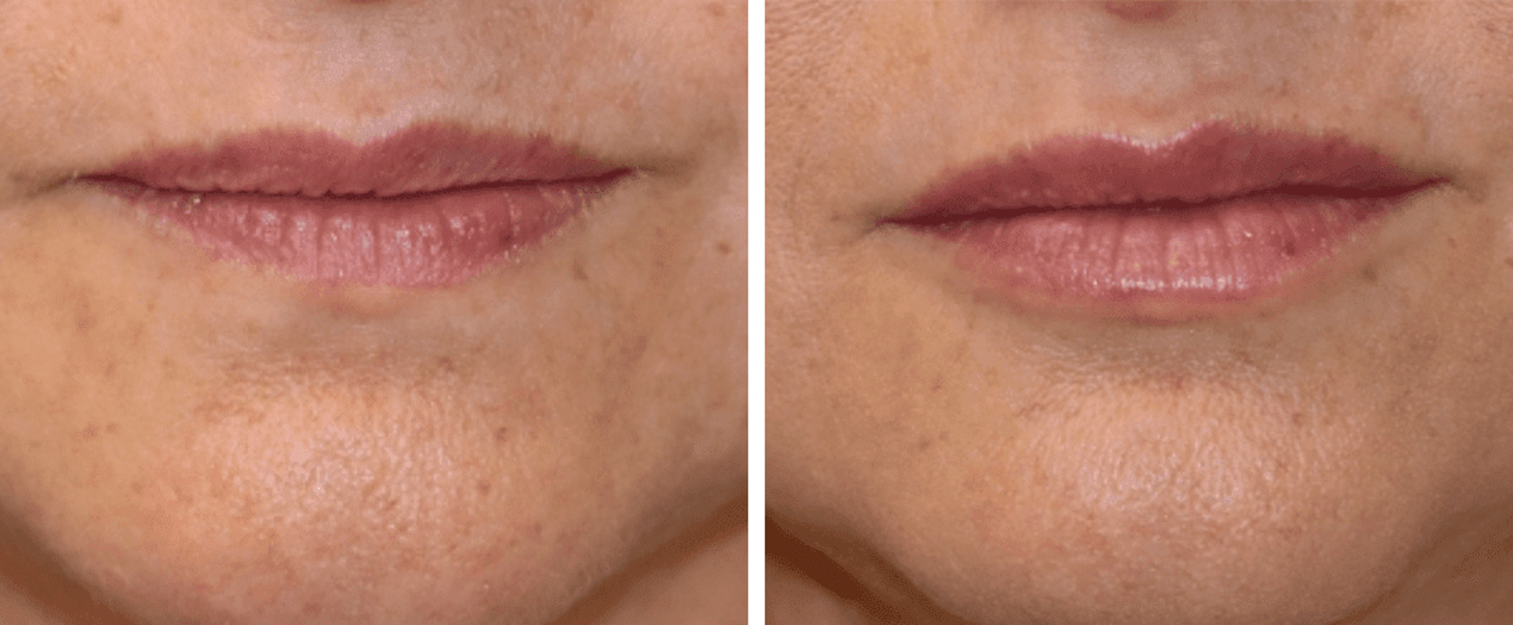 Eugenie Brunner, MD, FACS - Princeton, NJ