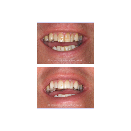 Fotos de St Pauls Dental Practice Ltd Fotos de St Pauls Dental Practice Ltd
