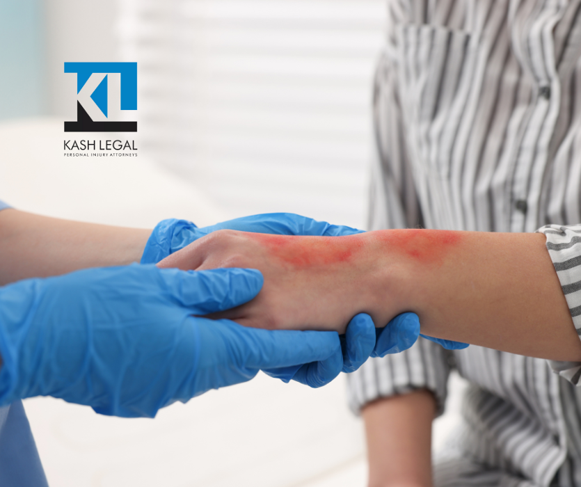 Kash Legal Group - Cupertino Personal Injury and Accident Lawyers Image