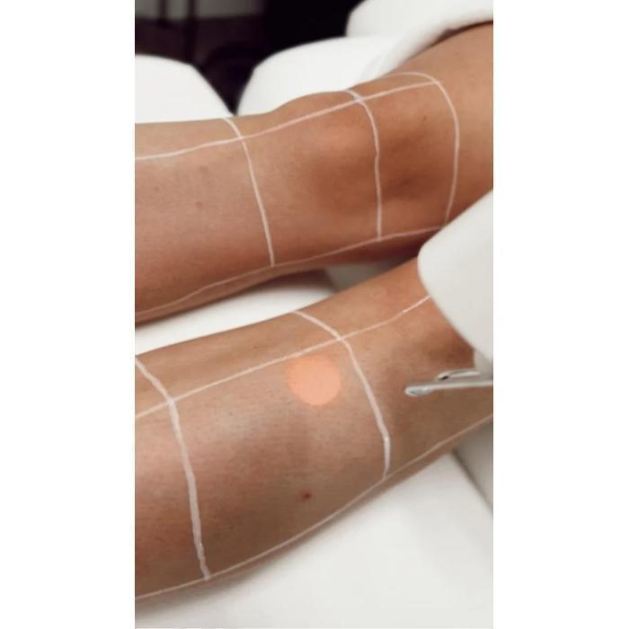 Leg Hair Removal in Prescott, AZ