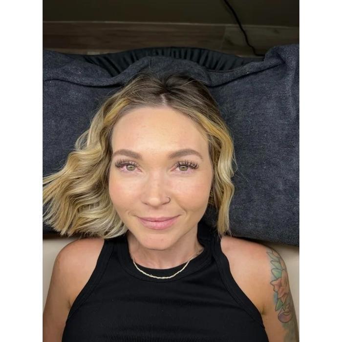 Laser Hair Removal in Prescott, AZ